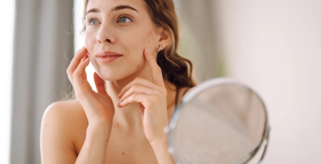 a person with acne looking in the mirror
